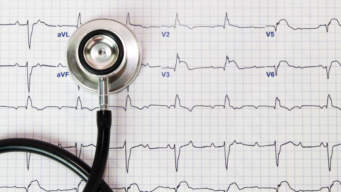 ecg-elettrocardiogramma in farmacia pelizzo a udine