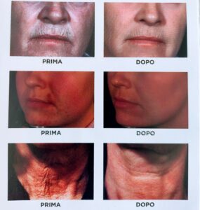 trattamenti viso e collo environ skincare, immagini prima e dopo 